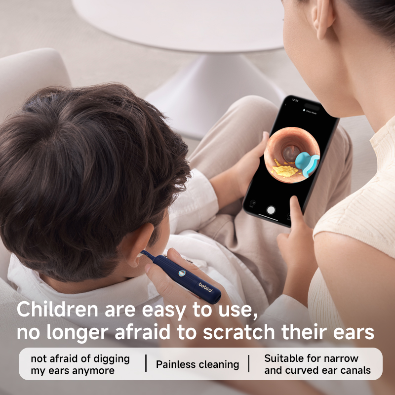2025 Yeni Varış Bebird EarSigh - Pet Ear Cleaner incelemesi ve fiyatı